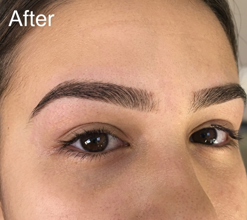 After Eyebrow Hair Remover