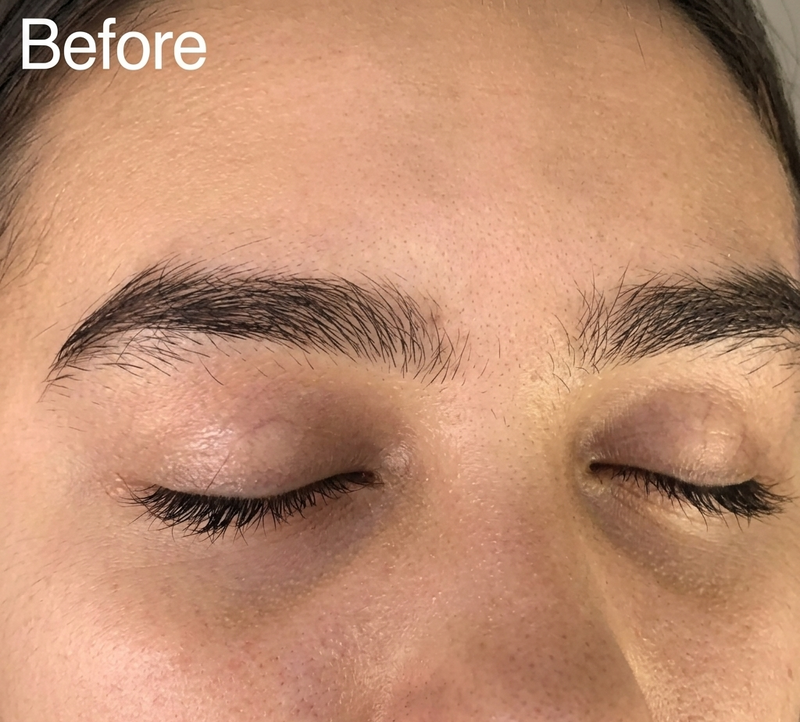 Before Eyebrow Hair Remover