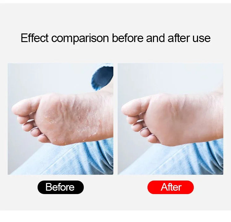 Professional Double-Sided Foot File & Callus Remover