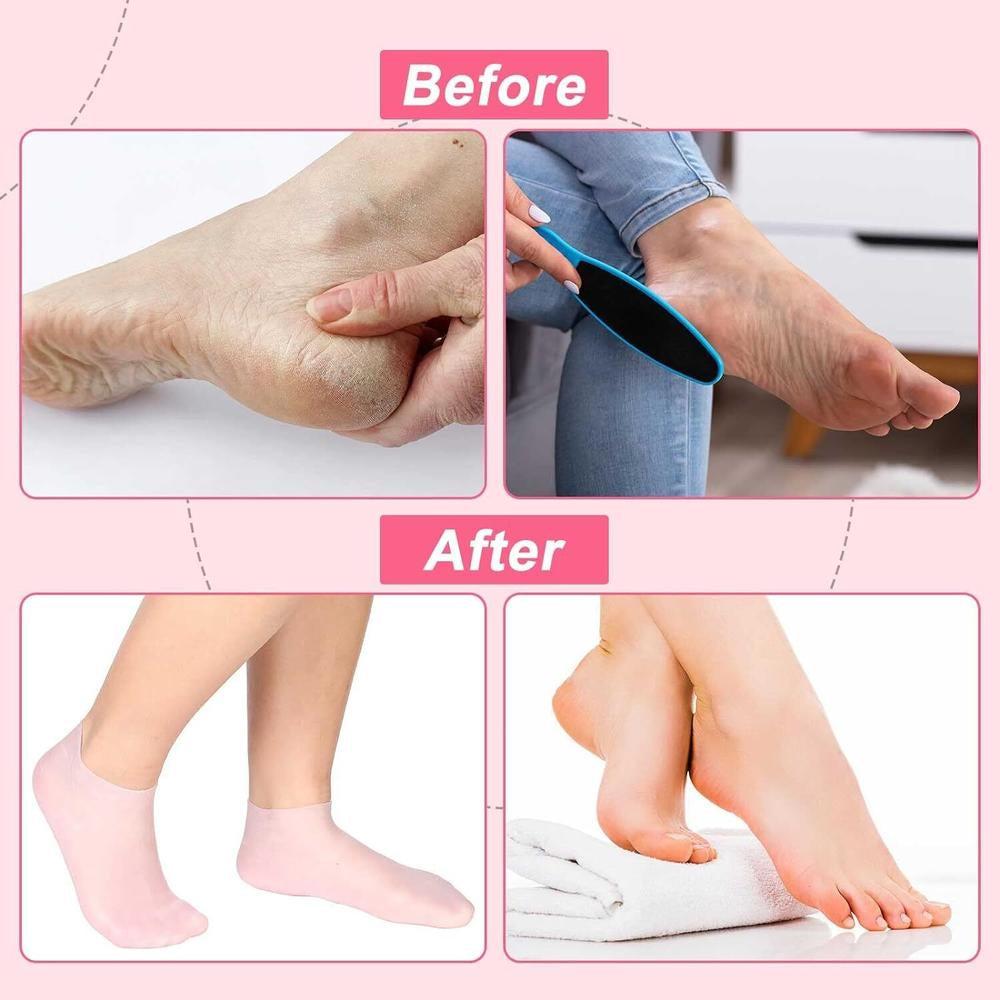2 Pcs Silicone Moisturizing Socks for Cracked Heels