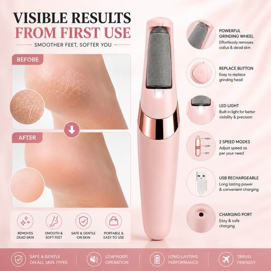 Find Back Electric Foot File Grinder – Callus & Dead Skin Remover for Smooth Heels